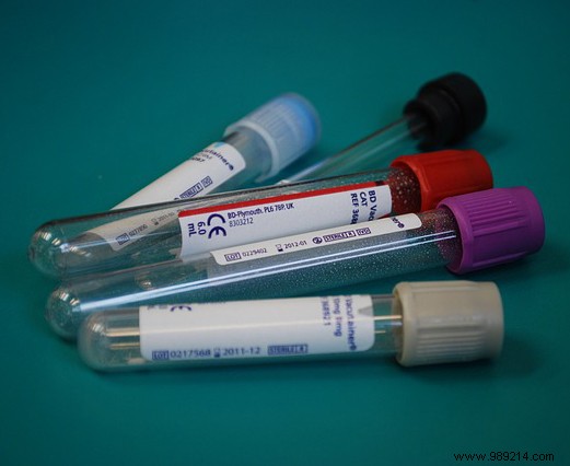 What Is Creatinine? Essential Guide to Kidney Function and Testing