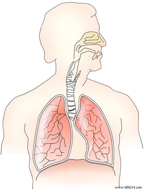 Asthmatic Bronchitis: Definition, Causes, Symptoms, and Proven Treatments