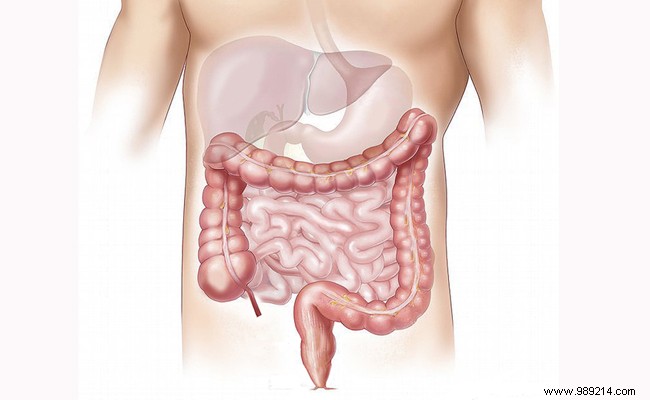 Constipation: Symptoms, Causes, Effective Treatments, and Prevention Tips