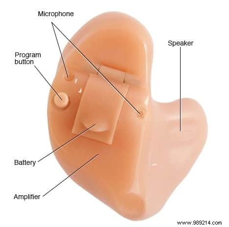 How Hearing Aids Effectively Compensate for Hearing Loss