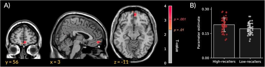 Why Do Some Dreams Fade While Others Linger? The Neuroscience of Dream Recall
