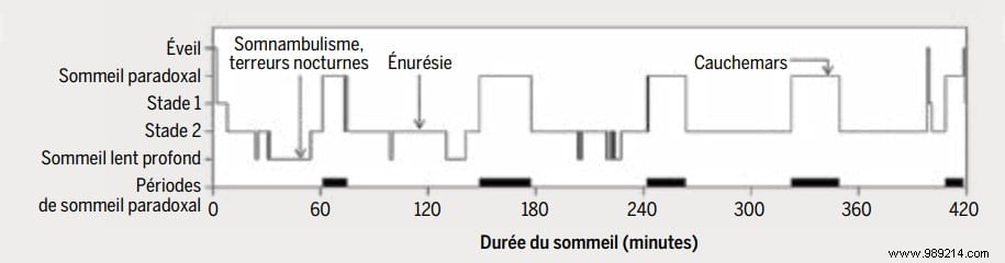 Why Children Have More Nightmares Than Adults: Expert Insights on Causes and Development