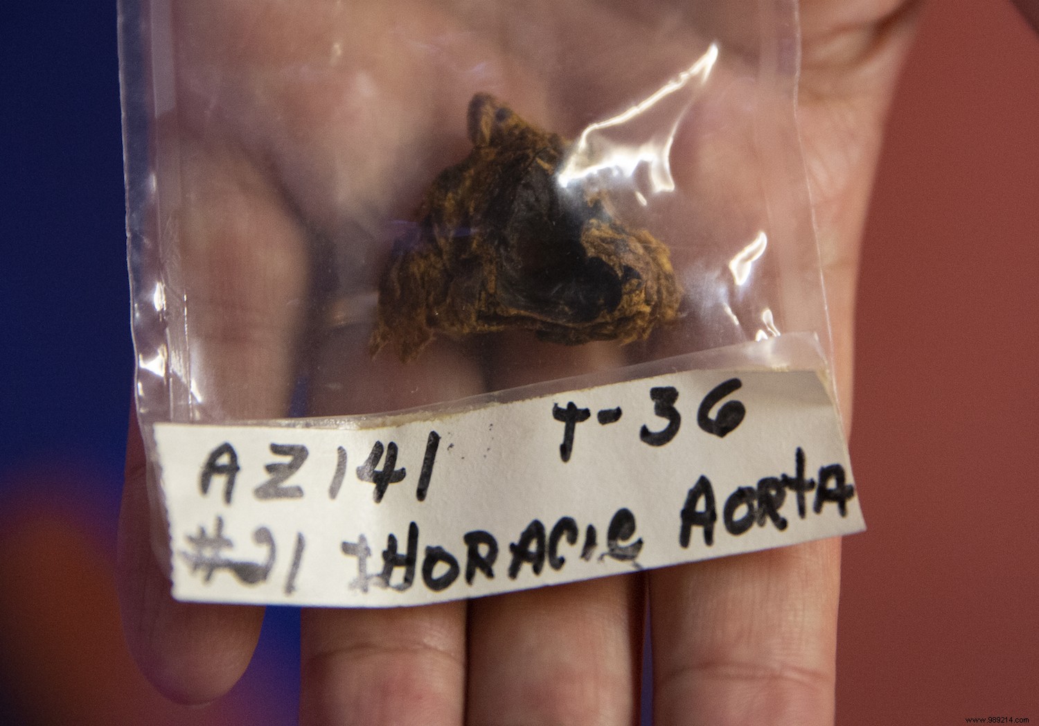 4,000-Year-Old Mummies Show High Cholesterol Levels, Hinting at Ancient Heart Disease