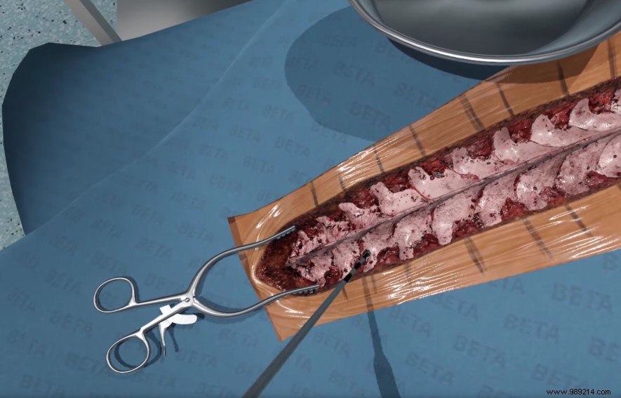 Fundamental Surgery: The Advanced VR Simulator Transforming Surgical Training