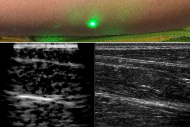 MIT Researchers Capture First Laser Ultrasound Images of Humans