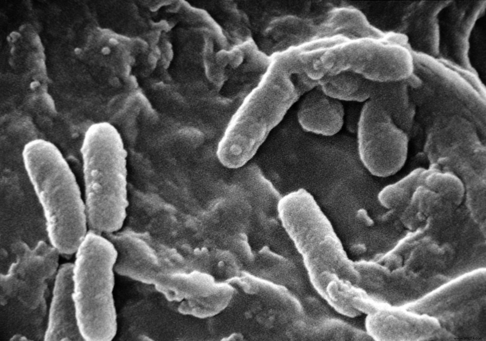 AI Breakthrough: MIT Researchers Discover Potent New Antibiotic Against Superbugs