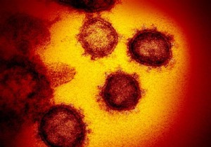 COVID-19 May Become Seasonal, Warns Dr. Anthony Fauci of NIAID