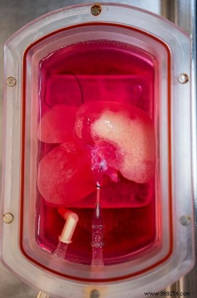 Bioengineered Mini Human Livers from Skin Cells Successfully Transplanted into Rats