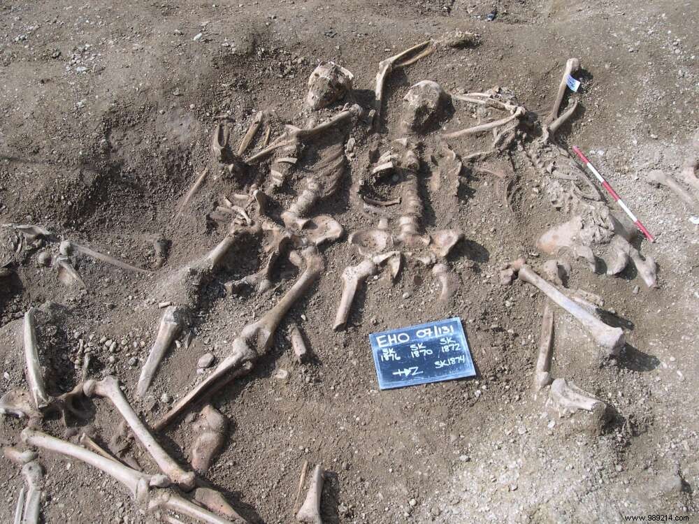 Ancient DNA from Viking Remains Reveals Smallpox Infection 1,400 Years Ago