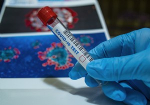 Israeli Doctor Tests Positive for COVID-19 Three Months After Initial Recovery