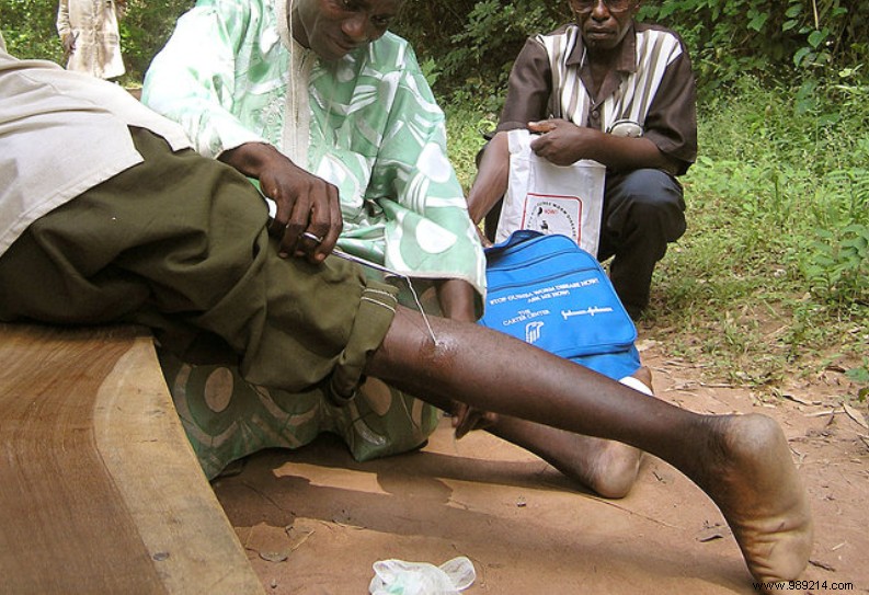 After Polio s Elimination in Africa: The Next Diseases Poised for Global Eradication