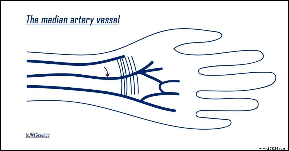 New Evidence Confirms Humans Are Still Evolving: The Rise of the Median Artery