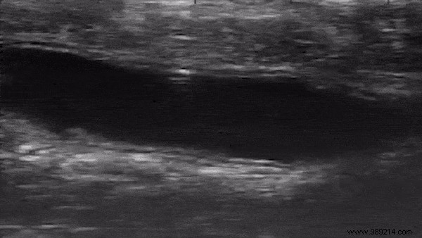 Purdue Researchers Successfully Navigate Micro-Robots Through Mouse Colons for Targeted Drug Delivery