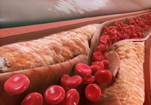 Climb 60 Stairs in Under 60 Seconds: A Simple Test for Heart Health