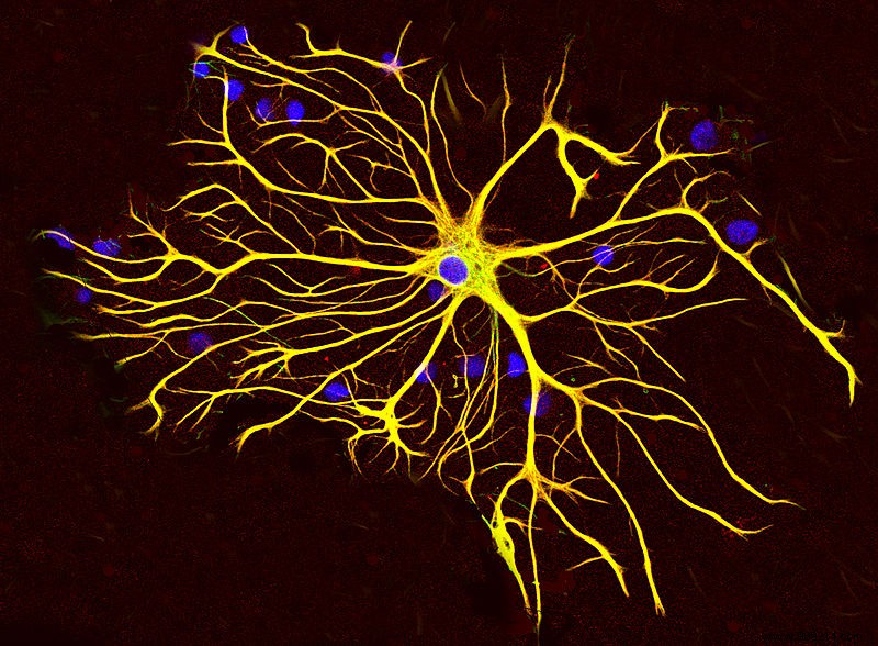 Study Finds Reduced Astrocytes in Brains of People with Depression Who Died by Suicide