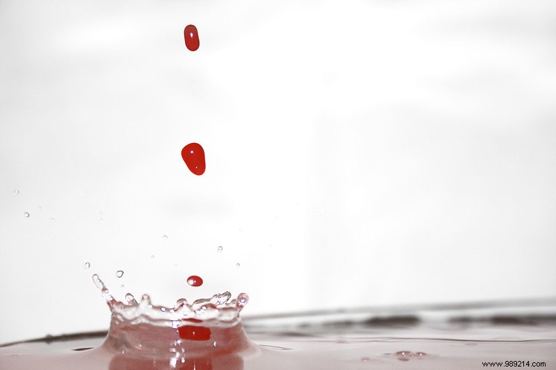 Rare Case: Woman Experiences Bloody Tears During Menstruation, Linked to Vicarious Bleeding