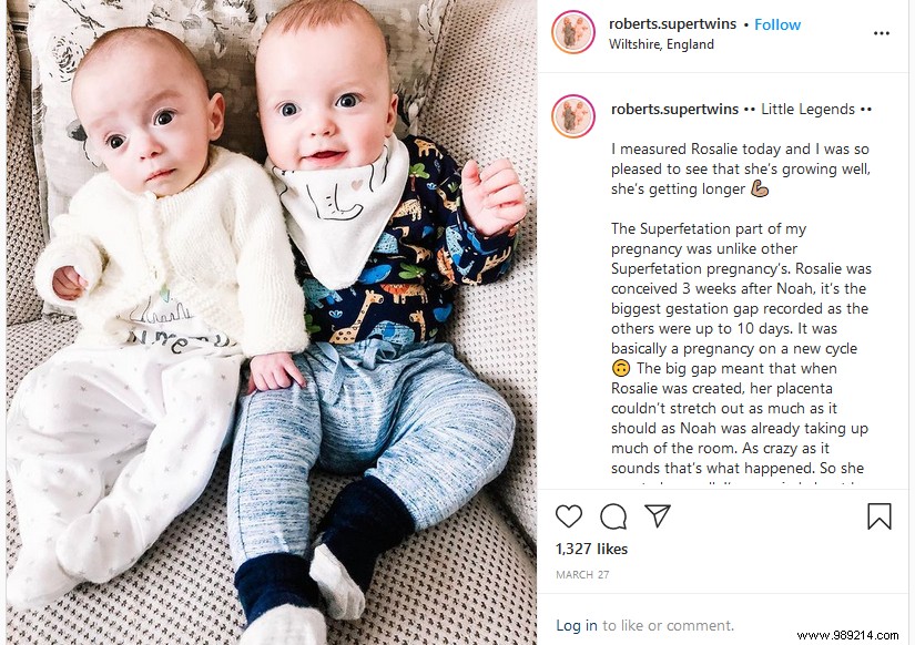 UK Mother Delivers Rare  Superfetation  Twins Conceived 3 Weeks Apart on the Same Day