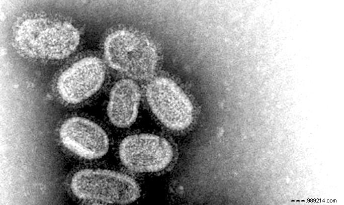 Two Influenza Strains May Have Vanished During COVID-19 Pandemic, Easing Vaccine Development