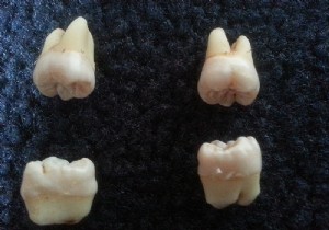Why Wisdom Teeth Emerge in Adulthood: Insights from Primate Jaw Biomechanics