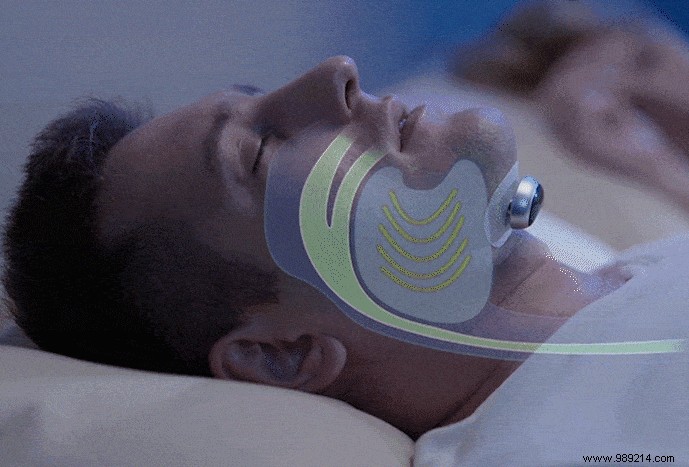 Snore Circle: The Innovative Non-Invasive Device to Combat Snoring Effectively