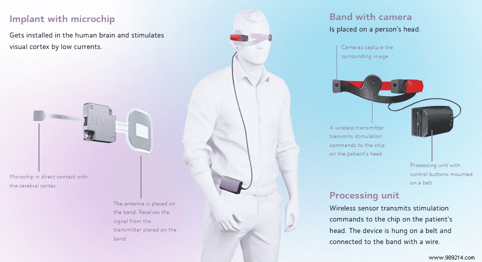Russian Neuroscientists Implant Neural Chip in Blind Baboon to Pioneer Vision Restoration
