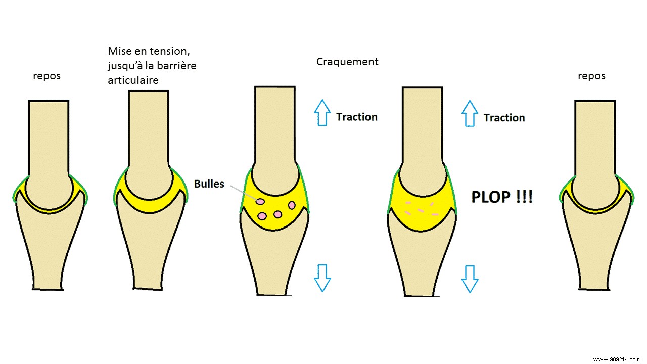 Cracking Your Joints: Debunking Myths and Uncovering Real Risks