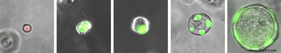 University of Pennsylvania Team Discovers Novel Respiratory Airway Secretory Cells in Human Lungs