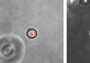 University of Pennsylvania Team Discovers Novel Respiratory Airway Secretory Cells in Human Lungs