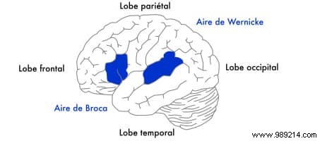Aphasia Explained: The Language Disorder That Led to Bruce Willis s Retirement